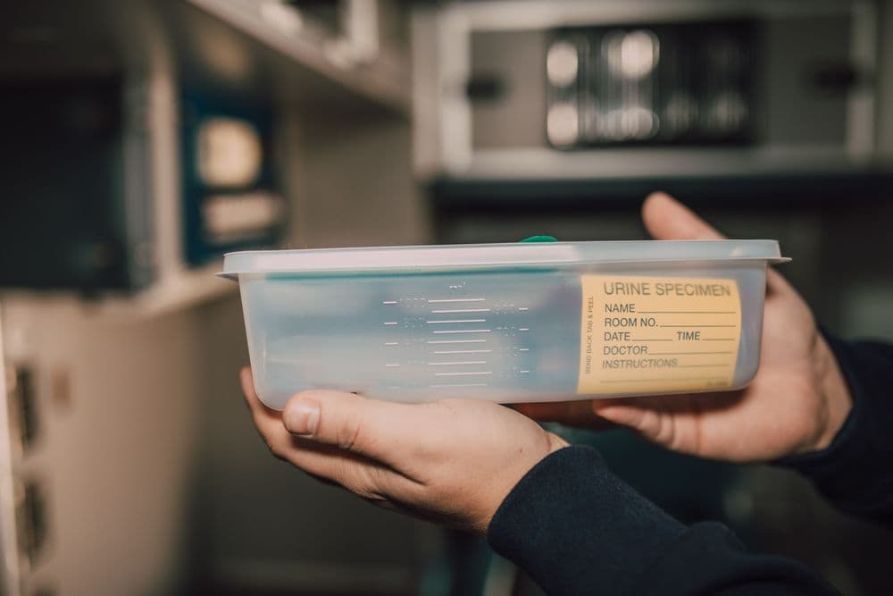 Hands holding a sealed urine specimen container with a paper label