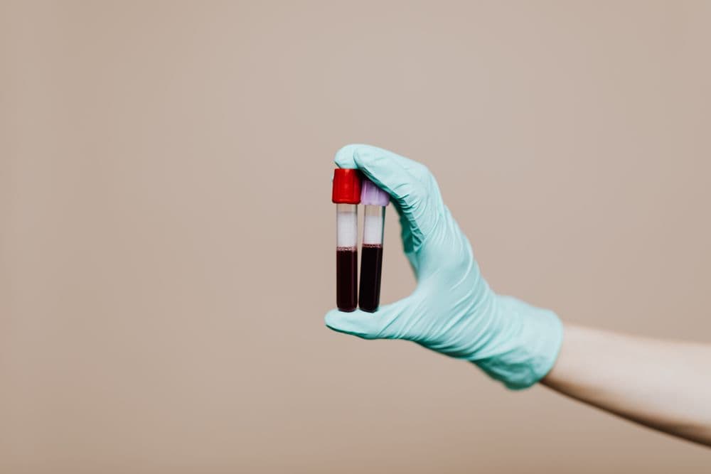 A gloved hand holding two blood sample tubes for lab testing